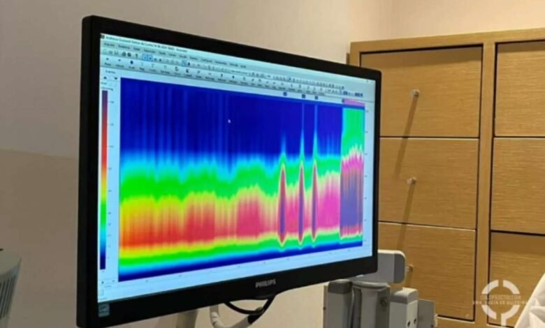 Manometria Anorretal: exame chave para avaliação da função anorretal - Dra. Lucia de Oliveira – Coloproctologista