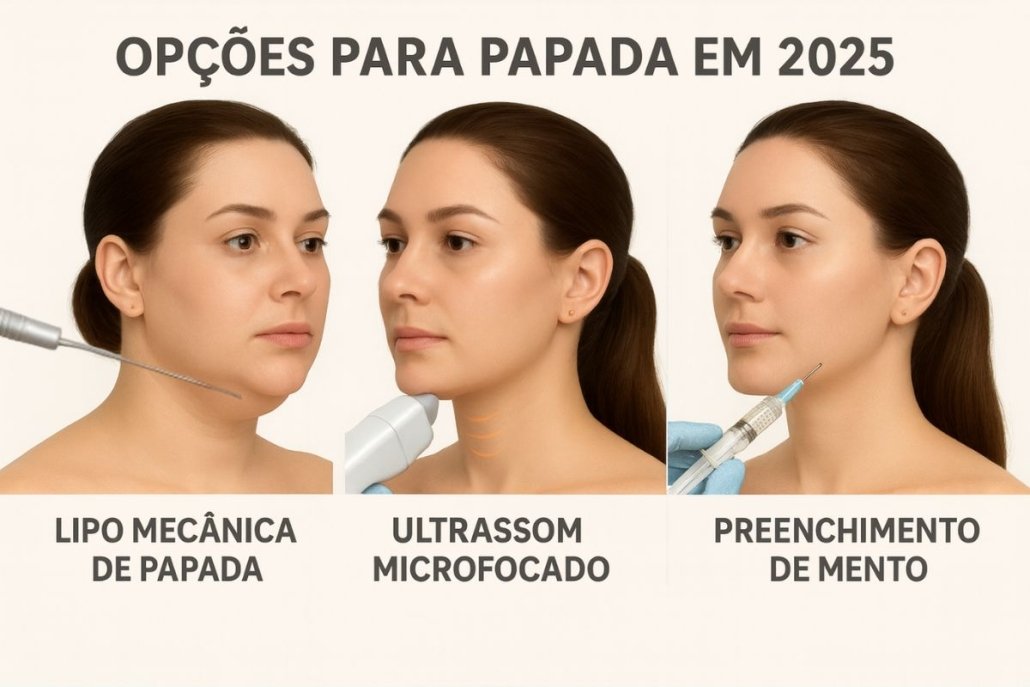 principais opções de procedimentos para papada em 2025