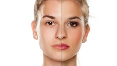 Custos e Acessibilidade na Harmonização Facial: Invista na Sua Confiança